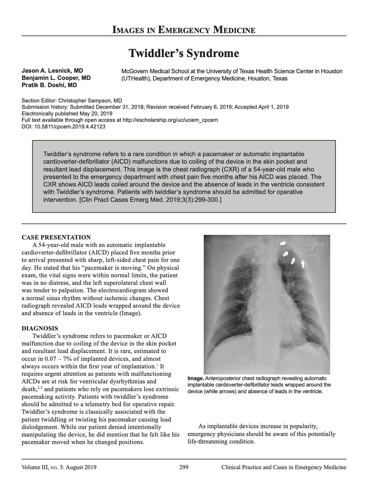 Lesnick JA, Cooper BL, Doshi PB. Twiddler’s Syndrome. Clin Pract Cases Emerg Med. 2019;3(3):299-300. Twiddler’s Syndrome