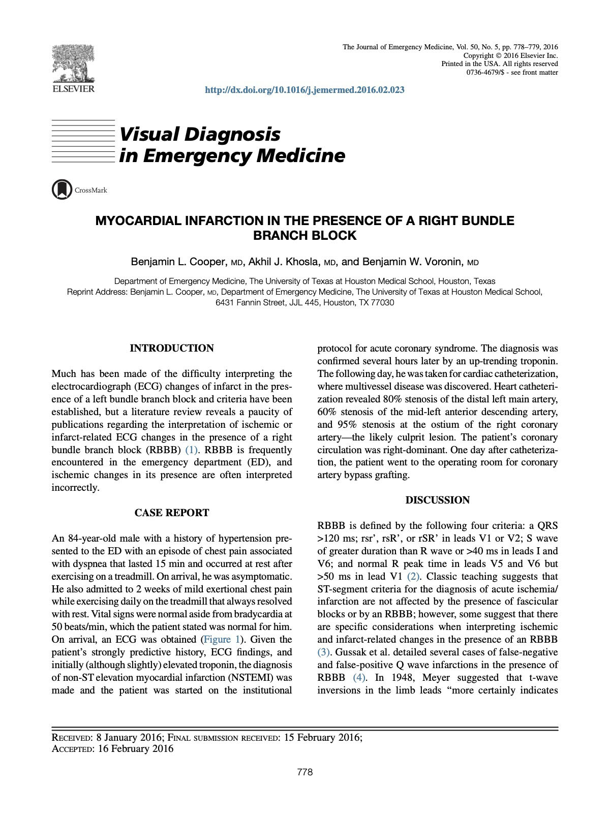 Cooper BL, Khosla AJ, Voronin BW. Myocardial infarction in the presence of a right bundle branch block. J Emerg Med. 2016;50(5):778-779. Myocardial infarction in the presence of a right bundle branch block