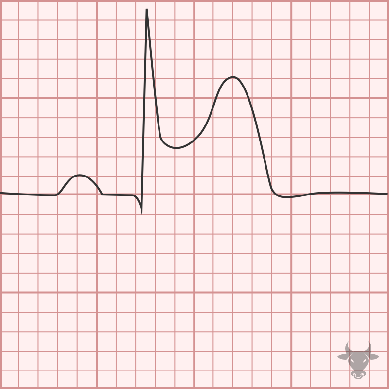 Aslanger Pattern
