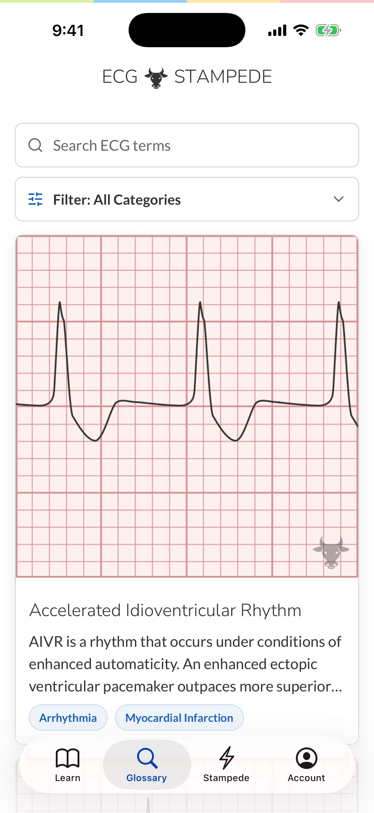 Visual ECG glossary in the ECG Stampede app